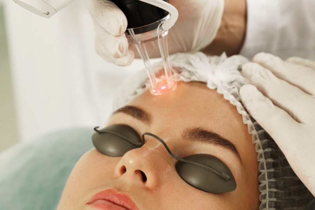 SADE Blog laser dermatológico
