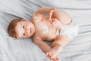 SADE Blog dermatitis niños